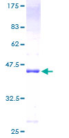 NIP45 / NFATC2IP Protein - 12.5% SDS-PAGE of human NFATC2IP stained with Coomassie Blue
