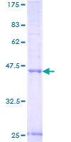 NIPAL3 / NPAL3 Protein - 12.5% SDS-PAGE of human DJ462O23.2 stained with Coomassie Blue