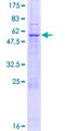 NIPSNAP1 Protein - 12.5% SDS-PAGE of human NIPSNAP1 stained with Coomassie Blue