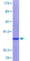 NIPSNAP1 Protein - 12.5% SDS-PAGE Stained with Coomassie Blue.