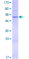 NIPSNAP3A Protein - 12.5% SDS-PAGE of human NIPSNAP3A stained with Coomassie Blue