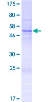 NIPSNAP3B Protein - 12.5% SDS-PAGE of human NIPSNAP3B stained with Coomassie Blue
