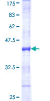 NIRF / UHRF2 Protein - 12.5% SDS-PAGE Stained with Coomassie Blue.