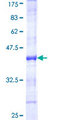 NIRF / UHRF2 Protein - 12.5% SDS-PAGE Stained with Coomassie Blue.