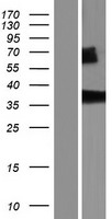 NIT1 Protein - Western validation with an anti-DDK antibody * L: Control HEK293 lysate R: Over-expression lysate