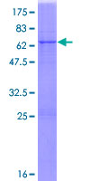 NIT1 Protein - 12.5% SDS-PAGE of human NIT1 stained with Coomassie Blue