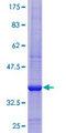 NIT1 Protein - 12.5% SDS-PAGE Stained with Coomassie Blue.