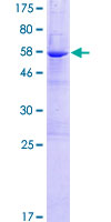 NIT2 Protein - 12.5% SDS-PAGE of human NIT2 stained with Coomassie Blue