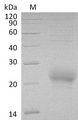 NK1 / CD160 Protein - (Tris-Glycine gel) Discontinuous SDS-PAGE (reduced) with 5% enrichment gel and 15% separation gel.