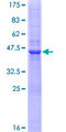 NK1 / CD160 Protein - 12.5% SDS-PAGE of human CD160 stained with Coomassie Blue