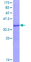 NK1 / CD160 Protein - 12.5% SDS-PAGE Stained with Coomassie Blue.