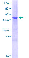 NKG2DL4 / ULBP4 Protein - 12.5% SDS-PAGE of human RAET1E stained with Coomassie Blue