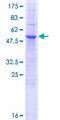 NKG2DL4 / ULBP4 Protein - 12.5% SDS-PAGE of human RAET1E stained with Coomassie Blue