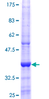 NKG2DL4 / ULBP4 Protein - 12.5% SDS-PAGE Stained with Coomassie Blue.