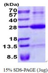 NKG2DL4 / ULBP4 Protein