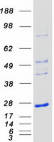 NKIRAS1 Protein - Purified recombinant protein NKIRAS1 was analyzed by SDS-PAGE gel and Coomassie Blue Staining