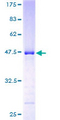 NKIRAS2 Protein - 12.5% SDS-PAGE of human NKIRAS2 stained with Coomassie Blue