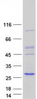 NKIRAS2 Protein - Purified recombinant protein NKIRAS2 was analyzed by SDS-PAGE gel and Coomassie Blue Staining