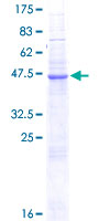 NKP30 Protein - 12.5% SDS-PAGE of human NCR3 stained with Coomassie Blue