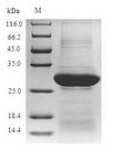 NKRF / NRF Protein - (Tris-Glycine gel) Discontinuous SDS-PAGE (reduced) with 5% enrichment gel and 15% separation gel.