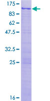 NKRF / NRF Protein - 12.5% SDS-PAGE of human NKRF stained with Coomassie Blue