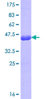 NKTR Protein - 12.5% SDS-PAGE Stained with Coomassie Blue.
