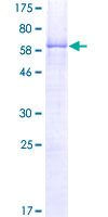 NKX2-1 / Thyroid-Specific TF Protein - 12.5% SDS-PAGE of human TITF1 stained with Coomassie Blue