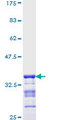 NKX2-1 / Thyroid-Specific TF Protein - 12.5% SDS-PAGE Stained with Coomassie Blue.