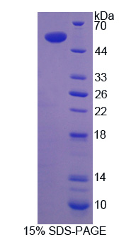 NKX2-1 / Thyroid-Specific TF Protein - Recombinant Transcription Termination Factor, RNA polymerase I By SDS-PAGE