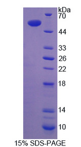 NKX2-1 / Thyroid-Specific TF Protein - Recombinant Transcription Termination Factor, RNA polymerase I By SDS-PAGE