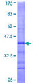 NKX2-2 Protein - 12.5% SDS-PAGE Stained with Coomassie Blue.
