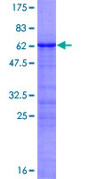 NKX2-3 Protein - 12.5% SDS-PAGE of human NKX2-3 stained with Coomassie Blue