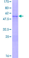 NKX2-8 Protein - 12.5% SDS-PAGE of human NKX2-8 stained with Coomassie Blue