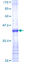 NKX3-1 Protein - 12.5% SDS-PAGE Stained with Coomassie Blue.