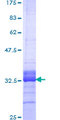 NKX3-2 / BAPX1 Protein - 12.5% SDS-PAGE Stained with Coomassie Blue.