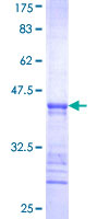 NKX6-2 Protein - 12.5% SDS-PAGE Stained with Coomassie Blue.