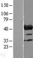 NLE1 Protein - Western validation with an anti-DDK antibody * L: Control HEK293 lysate R: Over-expression lysate