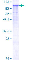 NLGN1 / Neuroligin 1 Protein - 12.5% SDS-PAGE of human NLGN1 stained with Coomassie Blue