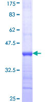 NLGN1 / Neuroligin 1 Protein - 12.5% SDS-PAGE Stained with Coomassie Blue.
