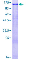 NLGN3 / Neuroligin 3 Protein - 12.5% SDS-PAGE of human NLGN3 stained with Coomassie Blue