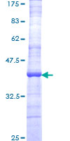 NLGN4X / KIAA1260 Protein - 12.5% SDS-PAGE Stained with Coomassie Blue.