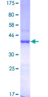 NLGN4Y Protein - 12.5% SDS-PAGE of human NLGN4Y stained with Coomassie Blue