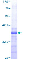 NLK Protein - 12.5% SDS-PAGE Stained with Coomassie Blue.