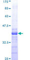 NLK Protein - 12.5% SDS-PAGE Stained with Coomassie Blue.