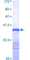 NLRP12 Protein - 12.5% SDS-PAGE Stained with Coomassie Blue.