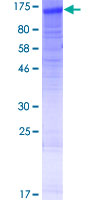 NLRP13 Protein - 12.5% SDS-PAGE of human NLRP13 stained with Coomassie Blue