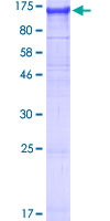 NLRP2 / NALP2 Protein - 12.5% SDS-PAGE of human NLRP2 stained with Coomassie Blue