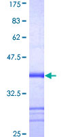 NLRP2 / NALP2 Protein - 12.5% SDS-PAGE Stained with Coomassie Blue.