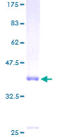 NMB / Neuromedin B Protein - 12.5% SDS-PAGE of human NMB stained with Coomassie Blue