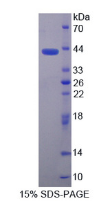 NMB / Neuromedin B Protein - Recombinant Neuromedin B By SDS-PAGE